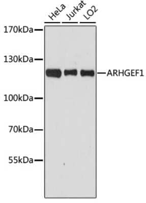 Western Blot: ARHGEF1 Antibody [NBP2-92963] - Analysis of extracts of various cell lines, using ARHGEF1 at 1:3000 dilution.Secondary antibody: HRP Goat Anti-Rabbit IgG (H+L) at 1:10000 dilution.Lysates/proteins: 25ug per lane.Blocking buffer: 3% nonfat dry milk in TBST.Detection: ECL Basic Kit .Exposure time: 90s.