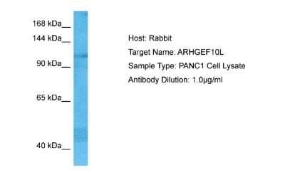 Western Blot: ARHGEF10L Antibody [NBP2-87031] - Host: Rabbit. Target Name: ARHGEF10L. Sample Tissue: Human PANC1 Whole Cell lysates. Antibody Dilution: 1ug/ml