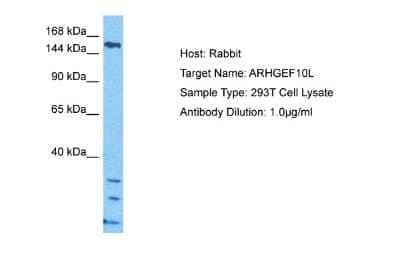 Western Blot: ARHGEF10L Antibody [NBP2-87032] - Host: Rabbit. Target Name: ARHGEF10L. Sample Tissue: 293T Whole Cell lysates. Antibody Dilution: 1ug/ml