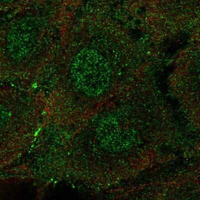 Immunocytochemistry/Immunofluorescence: ARHGEF15 Antibody [NBP2-56334] - Staining of human cell line HUVEC TERT2 shows localization to nucleoplasm & plasma membrane.