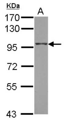 Western Blot: ARHGEF15 Antibody [NBP2-15455] - Sample (50 ug of whole cell lysate) A: Mouse Liver, 7. 5% SDS PAGE gel, diluted at 1:1000.