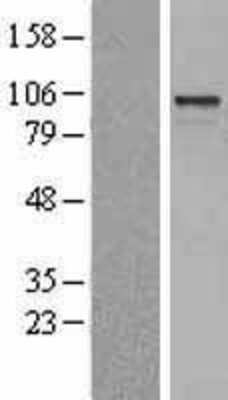 Western Blot: ARHGEF15 Overexpression Lysate (Adult Normal) [NBL1-07679] Left-Empty vector transfected control cell lysate (HEK293 cell lysate); Right -Over-expression Lysate for ARHGEF15.