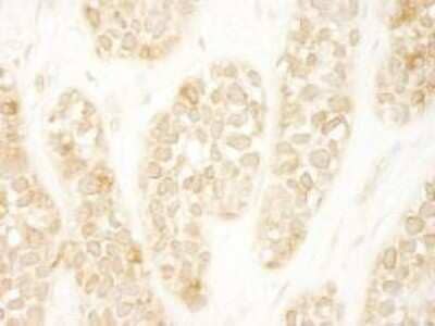 Immunohistochemistry-Paraffin ARHGEF16 Antibody