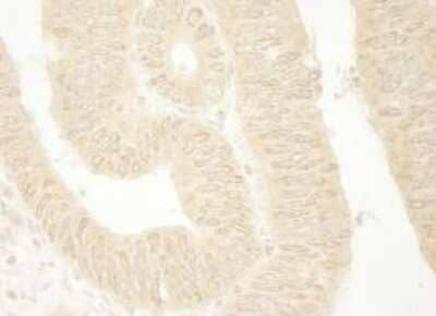 Immunohistochemistry-Paraffin ARHGEF16 Antibody