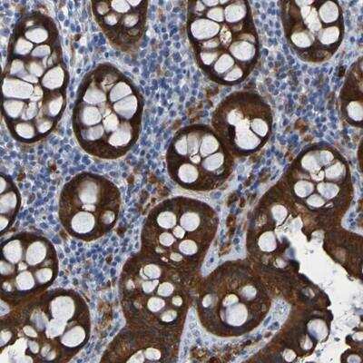 Immunohistochemistry-Paraffin: ARHGEF16 Antibody [NBP1-83372] - Staining of human colon shows strong cytoplasmic positivity in glandular cells.