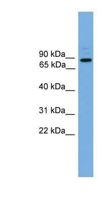 Western Blot: ARHGEF19 Antibody [NBP1-57038] - Hela cell lysate, concentration 0.2-1 ug/ml.