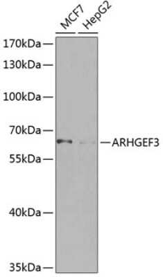 Western Blot: ARHGEF3 Antibody [NBP2-92834] - Analysis of extracts of various cell lines, using ARHGEF3 at 1:1000 dilution.Secondary antibody: HRP Goat Anti-Rabbit IgG (H+L) at 1:10000 dilution.Lysates/proteins: 25ug per lane.Blocking buffer: 3% nonfat dry milk in TBST.Detection: ECL Basic Kit .Exposure time: 60s.