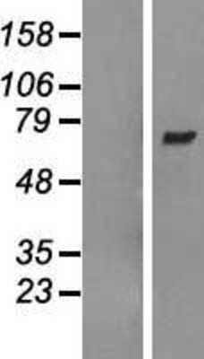 Western Blot: ARHGEF3 Overexpression Lysate (Adult Normal) [NBL1-07681] Left-Empty vector transfected control cell lysate (HEK293 cell lysate); Right -Over-expression Lysate for ARHGEF3.