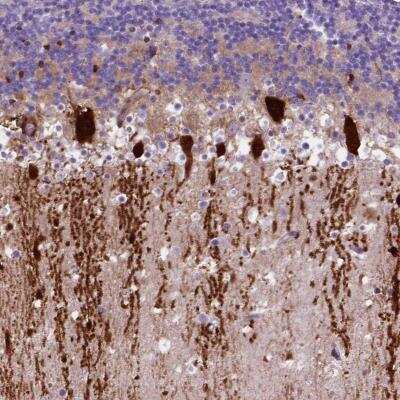 Immunohistochemistry: ARHGEF33 Antibody [NBP2-58937] - Immunohistochemical staining of human cerebellum shows cytoplasmic positivity in purkinje cells.