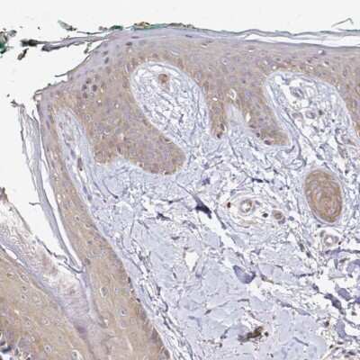 Immunohistochemistry-Paraffin: ARHGEF37 Antibody [NBP2-55383] - Immunohistochemical staining of human skin shows cytoplasmic positivity in epidermis.