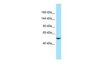 Western Blot: ARHGEF40 Antibody [NBP2-87038] - Host: Rabbit. Target Name: ARHGEF40. Sample Type: COLO205 Whole Cell lysates. Antibody Dilution: 1.0ug/ml