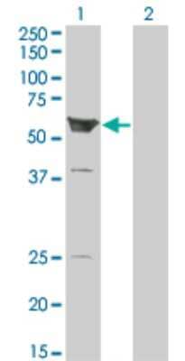 Western Blot ARHGEF5 Antibody (3A12-B5)