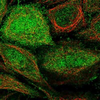 Immunocytochemistry/Immunofluorescence: ARHGEF5 Antibody [NBP1-83370] - Immunofluorescent staining of human cell line SiHa shows localization to nucleoplasm, plasma membrane & cytosol.