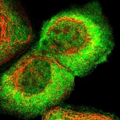 Immunocytochemistry/Immunofluorescence: ARHGEF5 Antibody [NBP1-83371] - Immunofluorescent staining of human cell line A-431 shows localization to nucleoplasm, plasma membrane & cytosol.