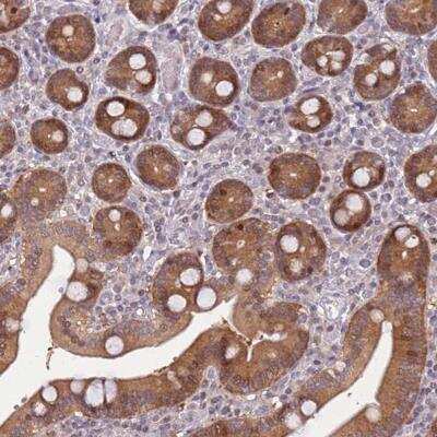 Immunohistochemistry: ARHGEF5 Antibody [NBP2-46701] - Staining of human duodenum shows moderate positivity in glandular cells.