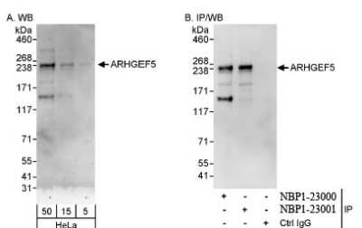 Western Blot ARHGEF5 Antibody