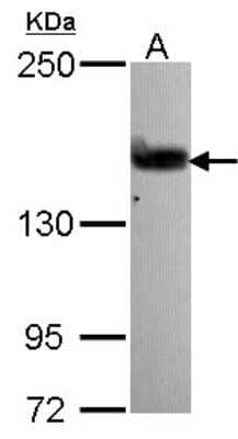 Western Blot: ARHGEF5 Antibody [NBP2-15457] - Sample (30 ug of whole cell lysate) A: A431 5% SDS PAGE gel, diluted at 1:1000.