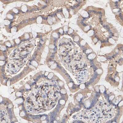 Immunohistochemistry-Paraffin: ARHGEF6 Antibody [NBP1-89124] - Staining of human small intestine shows weak cytoplasmic positivity in glandular cells.