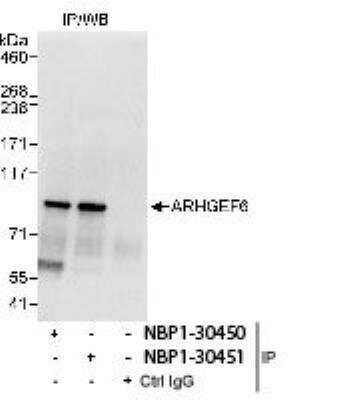 Immunoprecipitation: ARHGEF6 Antibody [NBP1-30451] - Detection of Human ARHGEF6 Whole cell lysate (1 mg for IP, 20% of IP loaded) from Jurkat cells. Antibodies: Affinity purified rabbit anti-ARHGEF6 antibody NBP1-30451 used for IP at 10 mcg/mg lysate. ARHGEF6 was also immunoprecipitated by rabbit anti-ARHGEF6 antibody NBP1-30450, which recognizes an upstream epitope.