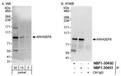 Western Blot: ARHGEF6 Antibody [NBP1-30450] - Detection of Human ARHGEF6 Whole cell lysate from Jurkat cells. ARHGEF6 was also immunoprecipitated by rabbit anti-ARHGEF6 antibody NBP1-30451.