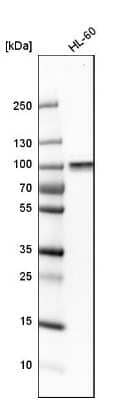 Western Blot: ARHGEF6 Antibody [NBP1-89124] - Analysis in human cell line HL-60.