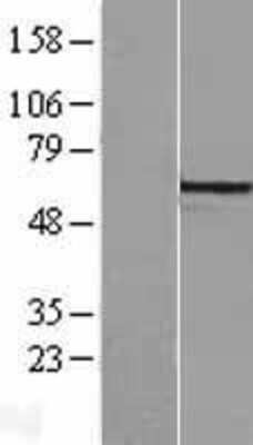 Western Blot: ARHGEF9 Overexpression Lysate (Adult Normal) [NBL1-07683] Left-Empty vector transfected control cell lysate (HEK293 cell lysate); Right -Over-expression Lysate for ARHGEF9.