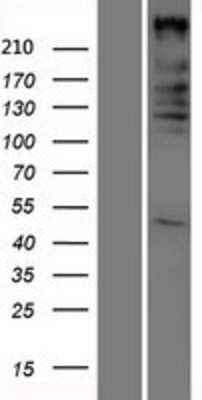 Western Blot: ARID1A Overexpression Lysate (Adult Normal) [NBP2-07670] Left-Empty vector transfected control cell lysate (HEK293 cell lysate); Right -Over-expression Lysate for ARID1A.