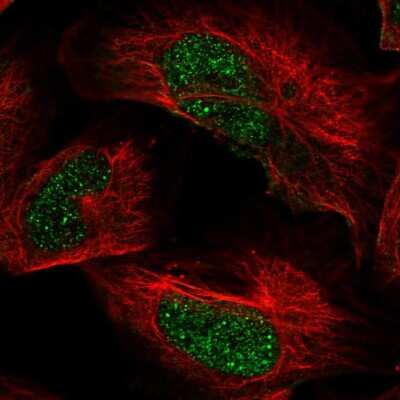 Immunocytochemistry/Immunofluorescence: ARID2 Antibody [NBP2-57220] - Staining of human cell line U-2 OS shows localization to nucleoplasm. Antibody staining is shown in green.