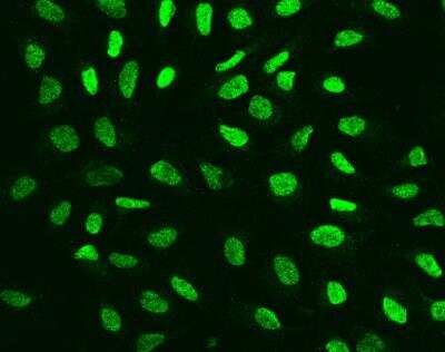 Immunocytochemistry/Immunofluorescence: ARID2 Antibody [NBP3-12715] - Staining of ARID2 in U2OS cells. Cells were fixed with 4% PFA, permeabilzed with 0.3% Triton X-100 in PBS,blocked with 10% serum, and incubated with rabbit anti-Human ARID2 polyclonal antibody (dilution ratio 1:200) at 4? overnight. Then cells were stained with the Alexa Fluor®488-conjugated Goat Anti-rabbit IgG secondary antibody (green). Positive staining was localized to Nucleus.