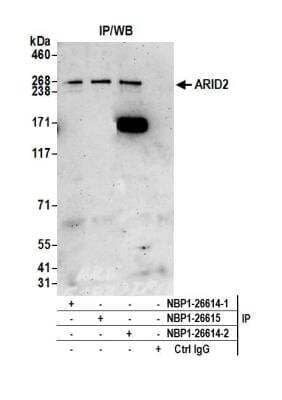 <b>Independent Antibodies Validation. </b>Immunoprecipitation: ARID2 Antibody [NBP1-26614] - Detection of human ARID2 by western blot of immunoprecipitates. Samples: Whole cell lysate (1.0 mg per IP reaction; 20% of IP loaded) from HeLa cells prepared using NETN lysis buffer. Antibodies: Affinity purified rabbit anti-ARID2 antibody NBP1-26614 (lot NBP1-26614-2) used for IP at 6 ug per reaction. ARID2 was also immunoprecipitated by a previous lot of this antibody (lot NBP1-26614-1) and rabbit anti-ARID2 antibody NBP1-26615. For blotting immunoprecipitated ARID2, NBP1-26614 was used at 1 ug/ml. Detection: Chemiluminescence with an exposure time of 3 minutes.