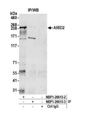 Immunoprecipitation: ARID2 Antibody [NBP1-26615] - Detection of human ARID2 by western blot of immunoprecipitates. Samples: Whole cell lysate (1.0 mg per IP reaction; 20% of IP loaded) from HeLa cells prepared using NETN lysis buffer. Antibodies: Affinity purified rabbit anti-ARID2 antibody NBP1-26615 (lot NBP1-26615-2) used for IP at 6 ug per reaction. ARID2 was also immunoprecipitated by a previous lot of this antibody (lot NBP1-26615-1). For blotting immunoprecipitated ARID2, NBP1-26615 was used at 1 ug/ml. Detection: Chemiluminescence with an exposure time of 30 seconds.