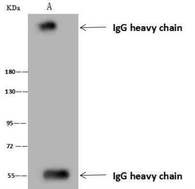 Immunoprecipitation: ARID2 Antibody [NBP3-12715] - Lane A:0.5 mg Jurkat Whole Cell Lysate4 uL anti-ARID2 rabbit polyclonal antibody and 60 ug of Immunomagnetic beads Protein A/G.Primary antibody:Anti-ARID2 rabbit polyclonal antibody,at 1:100 dilution Secondary antibody:Goat Anti-Rabbit IgG (H+L)/HRP at 1/10000 dilutionDeveloped using the ECL technique.Performed under reducing conditions.Predicted band size: 197 kDaObserved band size :250 kDa