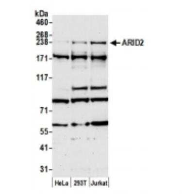 Western Blot: ARID2 Antibody [NBP1-26615] - Whole cell lysate (50 ug) from HeLa, 293T, and Jurkat cells prepared using NETN lysis buffer. Antibody: Affinity purified rabbit anti-ARID2 antibody used for WB at 0.04 ug/ml. Detection: Chemiluminescence with an exposure time of 75 seconds.