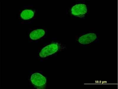 Immunocytochemistry/Immunofluorescence: ARID3B Antibody [H00010620-B01P] - Analysis of purified antibody to ARID3B on HeLa cell. (antibody concentration 10 ug/ml)