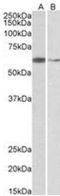 Western Blot: ARIH2 Antibody [NB100-1163] - Analysis of Hela (A) and K562 (B) nuclear lysates (35ug protein in RIPA buffer).