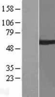 Western Blot: ARIH2 Overexpression Lysate (Adult Normal) [NBL1-07686] Left-Empty vector transfected control cell lysate (HEK293 cell lysate); Right -Over-expression Lysate for ARIH2.