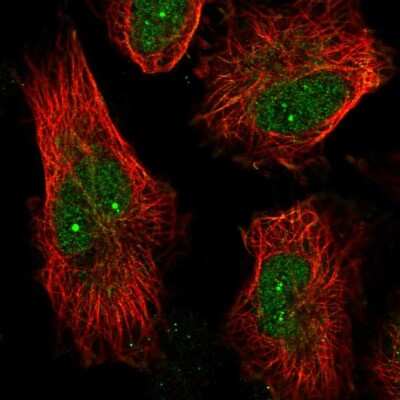 Immunocytochemistry/Immunofluorescence: ARK5/NUAK1 Antibody [NBP2-58038] - Staining of human cell line U-251 MG shows localization to nucleus, nucleoli fibrillar center & microtubules. Antibody staining is shown in green.