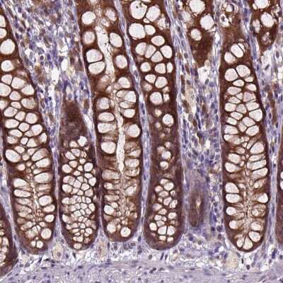 Immunohistochemistry: ARL1 Antibody [NBP2-49680] - Staining of human colon shows cytoplasmic positivity in glandular cells.