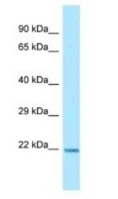 Western Blot: ARL1 Antibody [NBP1-98484] - Titration: 1.0 ug/ml Positive Control: MCF7 Whole Cell.