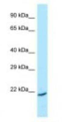 Western Blot: ARL1 Antibody [NBP1-98485] - HepG2 Cell Lysate 1.0ug/ml, Gel Concentration: 12%