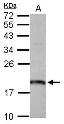 Western Blot: ARL1 Antibody [NBP2-15462] - Sample (30 ug of whole cell lysate) A: U87-MG 12% SDS PAGE gel, diluted at 1:1000.