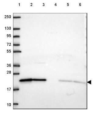 Western Blot: ARL1 Antibody [NBP2-49680] - Lane 1: Marker [kDa] 250, 130, 95, 72, 55, 36, 28, 17, 10Lane 2: Human cell line RT-4Lane 3: Human cell line U-251 MGLane 4: Human plasmaLane 5: Human Liver tissueLane 6: Human Tonsil tissue