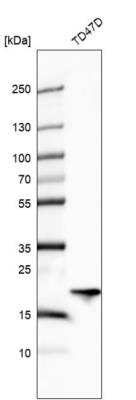 Western Blot: ARL1 Antibody [NBP2-57579] - Analysis in human cell line TD47D.