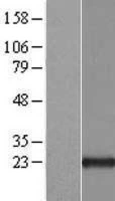 Western Blot: ARL1 Overexpression Lysate (Adult Normal) [NBL1-07687] Left-Empty vector transfected control cell lysate (HEK293 cell lysate); Right -Over-expression Lysate for ARL1.