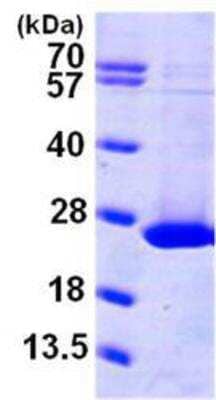 SDS-Page: Recombinant Human ARL1 Protein [NBP1-45312] - 15% SDS-PAGE (3ug)