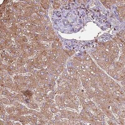 Immunohistochemistry-Paraffin ARL10 Antibody - BSA Free