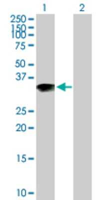 Western Blot: ARL10 Antibody [H00285598-B01P] - Analysis of ARL10 expression in transfected 293T cell line by ARL10 polyclonal antibody.  Lane 1: ARL10 transfected lysate(30.36 KDa). Lane 2: Non-transfected lysate.