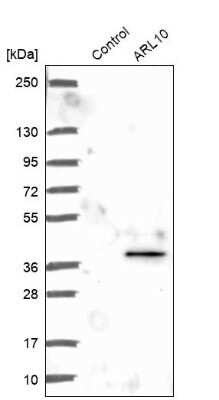 Western Blot ARL10 Antibody - BSA Free