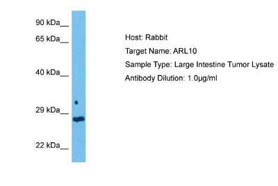 Western Blot: ARL10 Antibody [NBP2-84457] - Host: Rabbit. Target Name: ARL10. Sample Tissue: Human Large Intestine Tumor lysates. Antibody Dilution: 1ug/ml