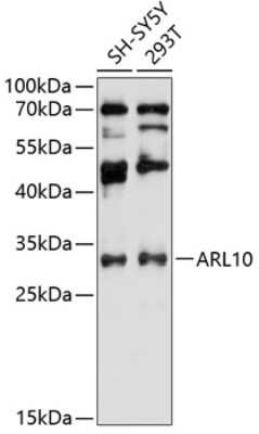 Western Blot: ARL10 Antibody [NBP2-92089] - Analysis of extracts of various cell lines, using ARL10 .Exposure time: 90s.